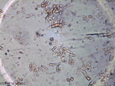 phyto/Brazilian_Amazon_coast/Amazomix_station_20/AMAZOMIX September 2021/Protoperidinium pyriforme (Am_ST20_r2_dcm_proto_cf_steini240830_005)(copy)_thumb.jpg